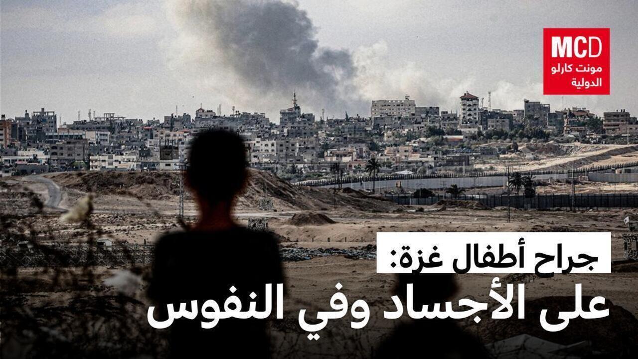 جراح أطفال غزة: على الأجساد وفي النفوس